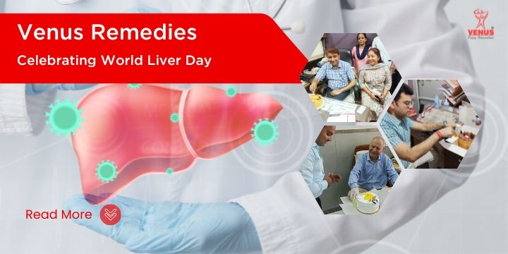 Celebrating World Liver Day 2023 with Satmax: A Mango Flavour Extravaganza!